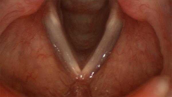 Vocal folds in the closed position during voicing